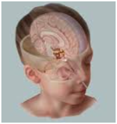 Pediatric Neurosurgery